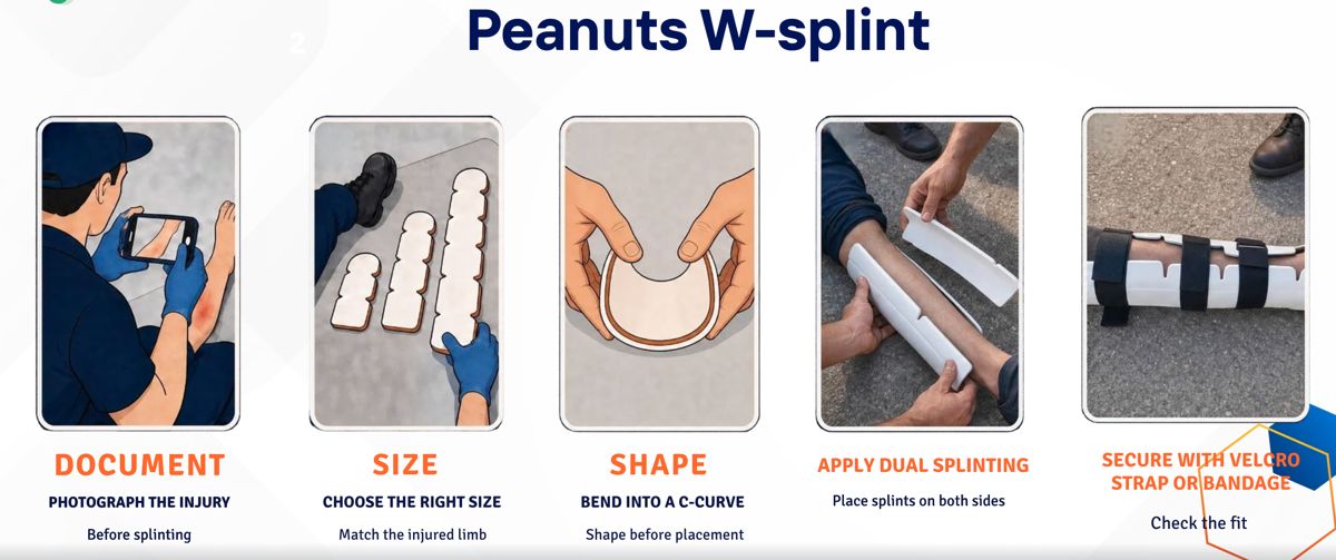 Peanuts W-Splint